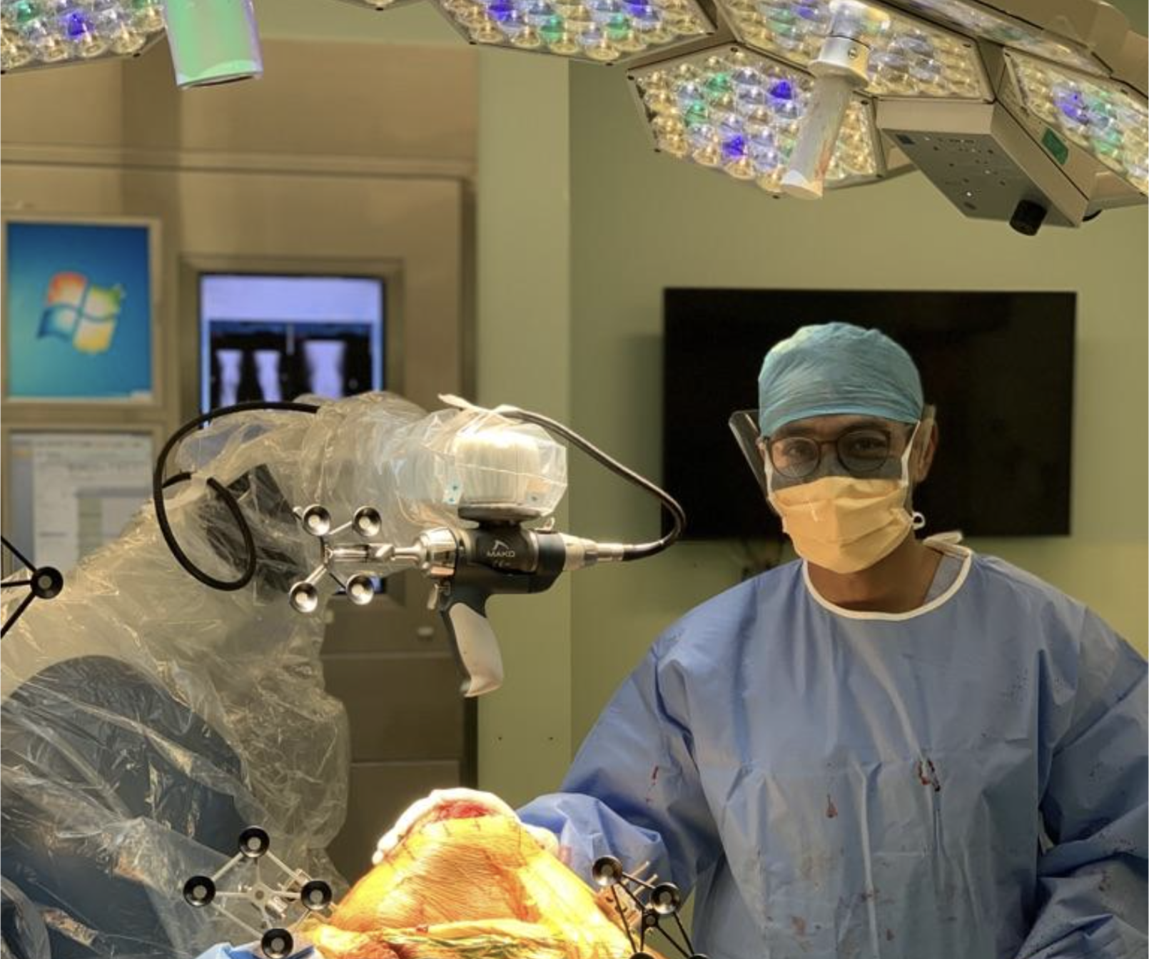 Robot Assisted Mako Total Knee Replacement